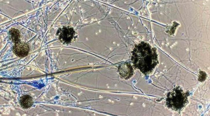 Bangladesh reports first suspected black fungus death