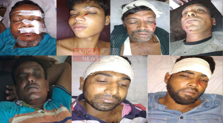 কুষ্টিয়ায় আ’লীগের দু’গ্রুপের সংঘর্ষে আহত ২৫ 