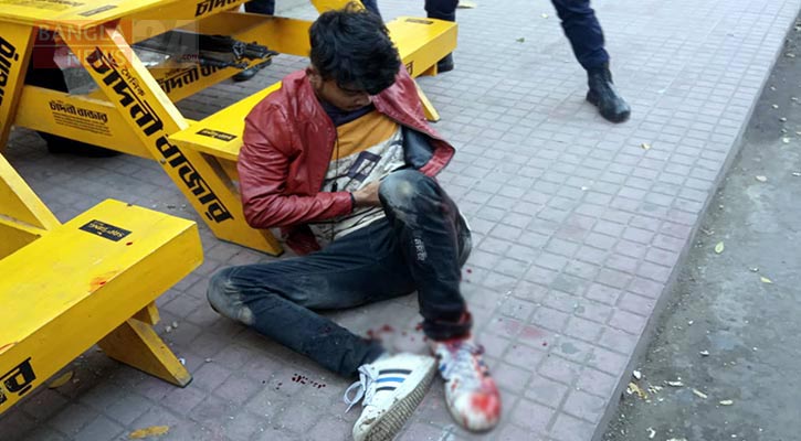 বগুড়ায় ছুরিকাঘাতে যুবক আহত