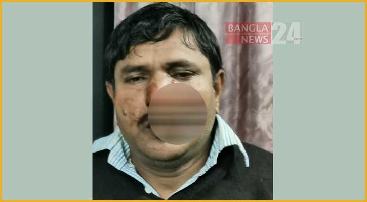 হামলা চালিয়ে দেড় লাখ টাকা ছিনতাই, গ্রেপ্তার ১