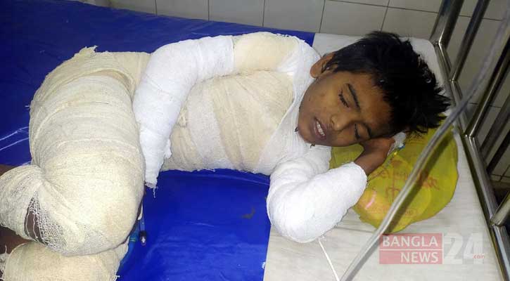রিকশা চালকের দেওয়া আগুনে দগ্ধ পথশিশু