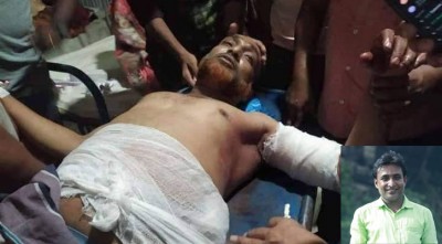 মাদারীপুরে স্বেচ্ছাসেবক লীগ নেতাকে কুপিয়ে জখম