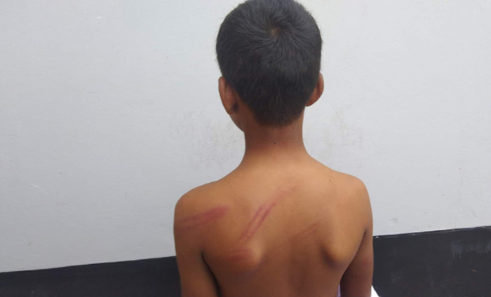 চুরির অপরাধে শিক্ষার্থীকে খুঁটির সঙ্গে বেঁধে নির্যাতন