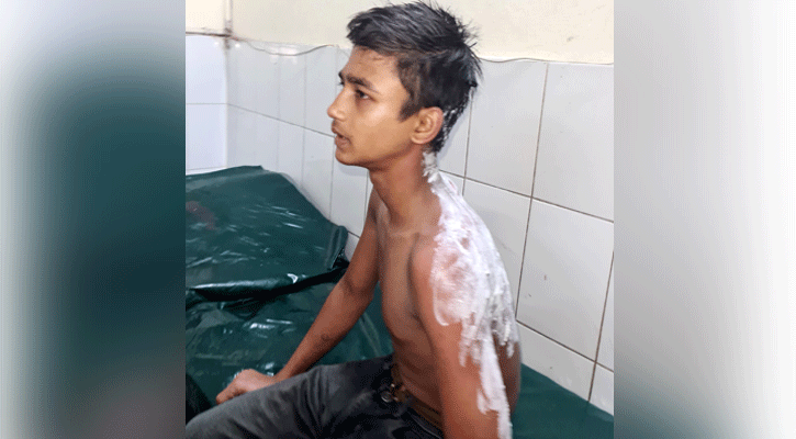 কিশোর কর্মচারীর গায়ে ভাতের গরম মাড় ঢেলে দিল বাবুর্চি!