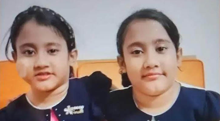 বার্ন ইনস্টিটিউটের সিসিইউতে কুমিল্লার যমজ বোন সারিনা-সাইবা
