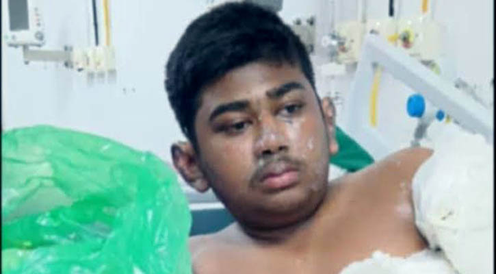 অল্পের জন্য প্রাণে বেঁচে গেছে মাদারীপুরের কাব্য