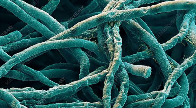 অ্যানথ্রাক্স প্রতিরোধে সমন্বিত কার্যক্রম শুরু